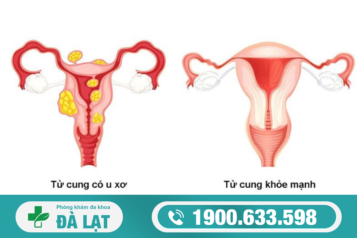 Hình ảnh minh họa